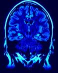 cerveau